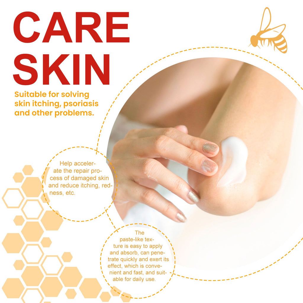 Bee-Poison Cowhide Moss Cream, Which Relieves Redness And Itchiness Of Skin
