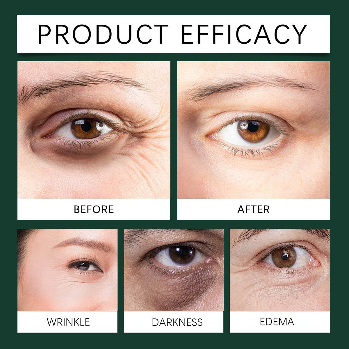 Mint Essence Eye Roller, Fade Fine Lines Crow's Feet Moisturizing Elastic Eye Anti-Wrinkle