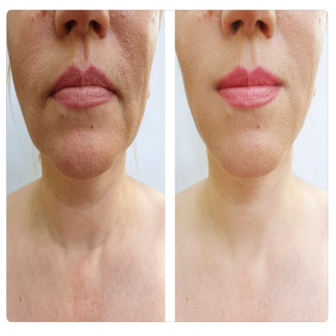 ORGANIC NECK RENEWAL CREAM - For Women