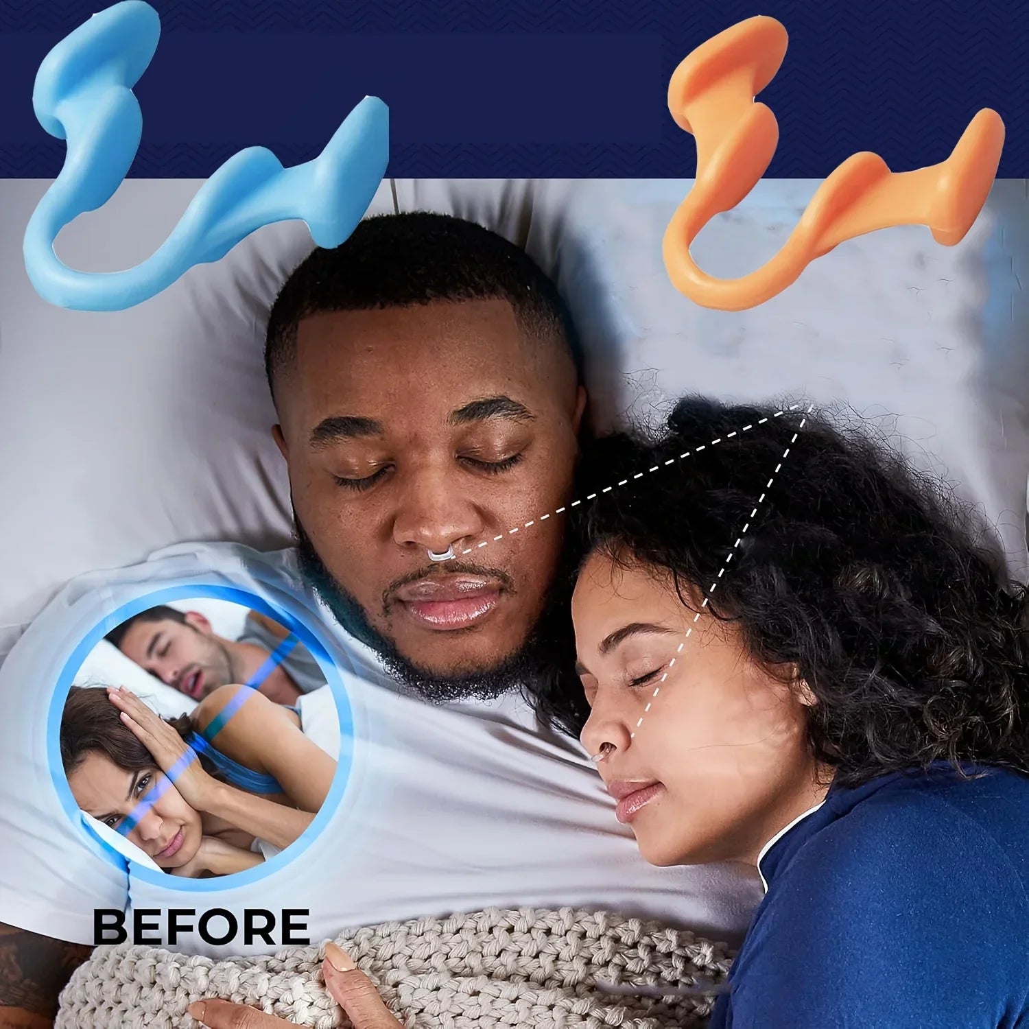 Silicone Nose Expanders for Snoring Relief | Battery-Free Sleep Aid