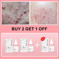 Collagen Peptide Facial Serum Targets Dull Skin Boosts Skin Elasticity Stimulates Skin Renewal Repair Salmon PDRN KOREAN Product